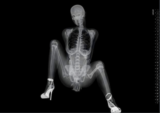 Illustration for article titled X-Ray Console Quiz!